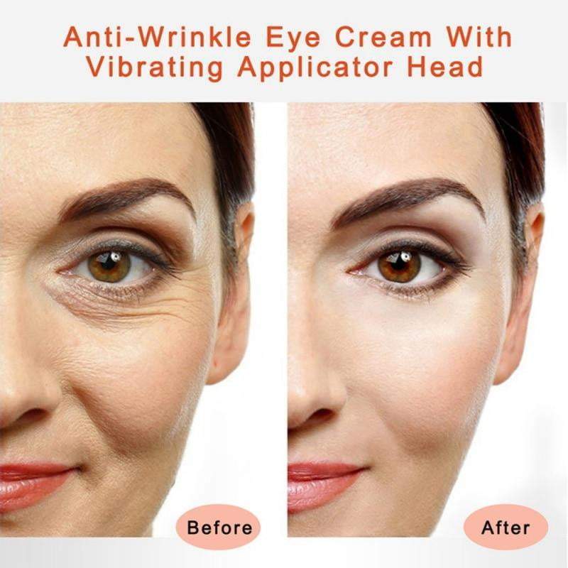 Anti-wrinkle Electric Massaging Cream - Etrendpro