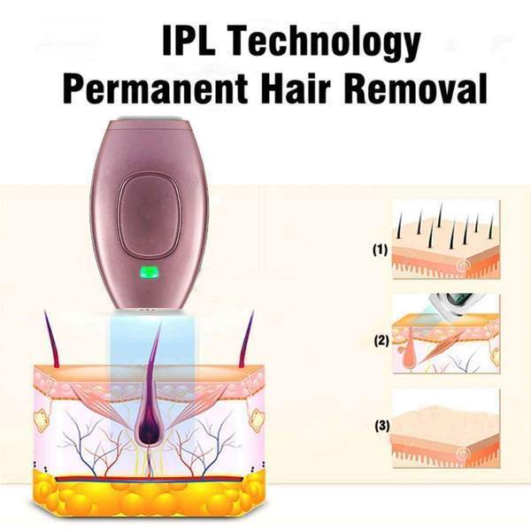 Laser Hair Removal IPL - Etrendpro